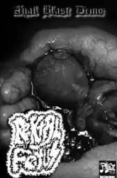 Rektal Fetus : Anal Blast